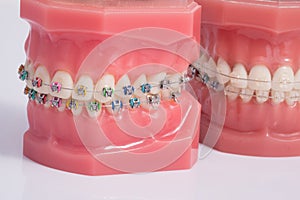 Dentist demonstration teeth model of varities of orthodontic bra