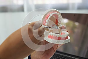 Dentist Dental check-up Dental treatment Oral treatment.