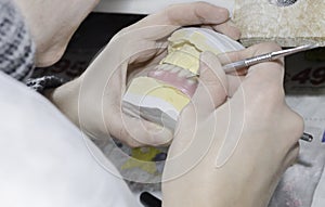 A dentist / dental technician working the partial denture