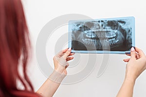 Dentist doctor checking dental x-ray orthopantomogram. Dental panoramic radiography