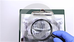 A dentist doctor examines a photograph of the teeth of a patient who has problems and teeth are inserted. The concept of research