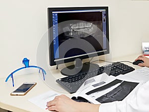 Dentist doctor works at a computer