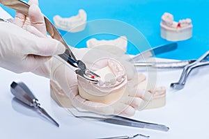 Dentist examinates the teeth mold