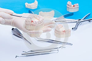Dentist examinates the teeth mold