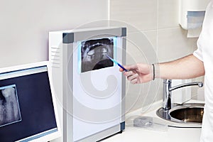 A dentist examines a patient`s x-ray picture