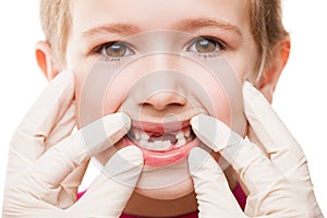 Dentist examining child teeth