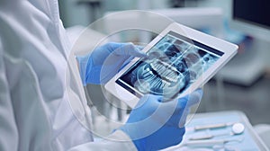 The Dental X-ray on Tablet.AI generated image