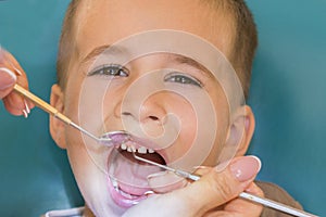 Dentist examining little boy& x27;s teeth in clinic. Close up of boy having his teeth examined by a dentist. A child at the dental