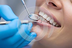 Dentist examining a patient's teeth in the dentist