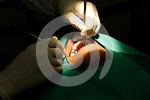 Dentist examining a patients teeth in the dentists chair under bright light at the dental clinic