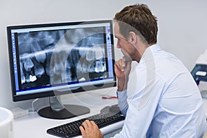 Dentist examining an x-ray on computer in dental clinic