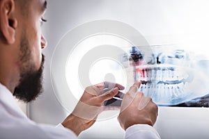 Dentist Examining Teeth X-ray