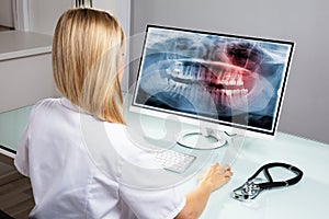 Dentist Examining Teeth X-ray On Computer
