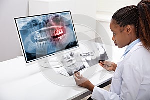 Dentist Examining Teeth X-ray On Computer