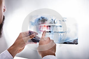 Dentist Examining Teeth X-ray