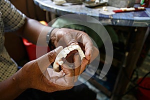 Dentist, Falam, Myanmar (Burma)