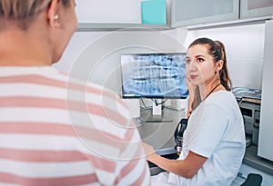 Dentist female doctor in uniform showing intraoral 3D dental X-rays scan to patient on PC screen. Dental clinic patient visit