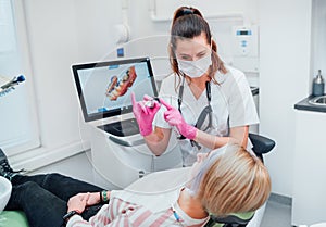 Dentist female doctor in uniform using intraoral 3D dental scanner Machine for clear aligners production. Dental clinic patient
