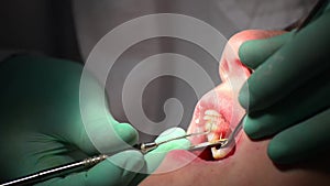 Dentist fixing girl's teeth