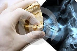 Dentist hand hold teethes model over x-ray