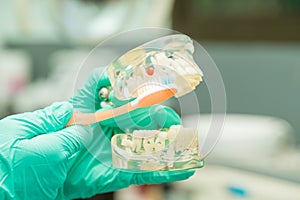 Dentist hand holding dental model and demonstrate