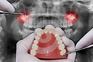 Dentist hand simulates dental surgery