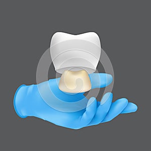 Dentist hand wearing blue protective surgical glove holding a ceramic model of the tooth. 3d realistic vector illustration of a