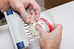 Dentist hands with color guide and plaster model