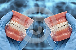 Dentist hands show dental model smiling over x-ray