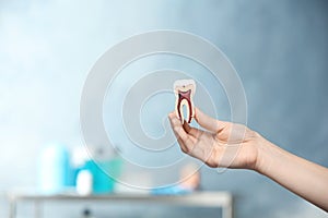 Dentist holding educational model of tooth on blurred background.