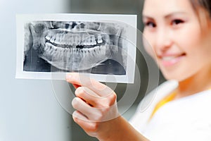 Dentist looking at x-ray picture