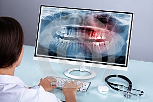 Dentist Looking At Teeth X-ray On Computer