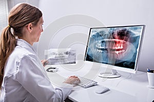 Dentist Looking At Teeth X-ray On Computer photo