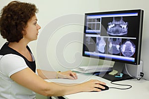 Dentist looks jaw X-rays at computer monitor