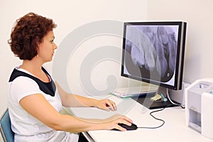 Dentist looks at jaw x-ray image on monitor photo