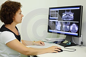 Dentist looks jaw X-rays at computer monitor photo