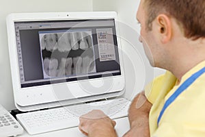 Dentist looks at teeth X-rays at computer monitor