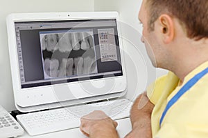 Dentist looks at teeth X-rays at computer monitor photo