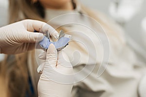 The dentist makes a dental impression to install braces for the patient. Close-up. Real people.