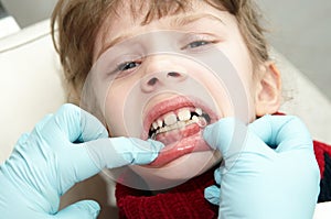 At dentist medic orthodontic doctor photo