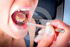 Dentist mirror reflects backend of front teeth