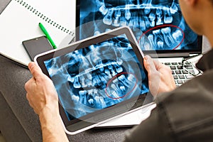 Dentist Office-Digital tablet with a patients x-rays