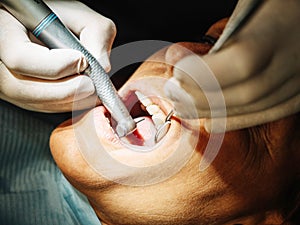 Dentist opens the mouth of his patient and begins to revise the interior helped by his instruments