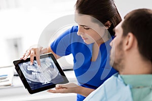 Dentist and patient with teeth x-ray on tablet pc