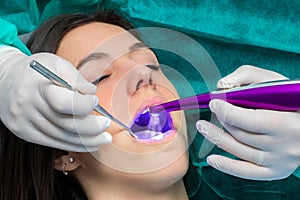 Dentist preventing tooth decay with led curing light on girl. photo
