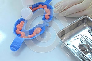 Dentist puts fluoride gel in mouth guard in stomatology clinic, hands closeup.