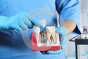 Dentist putting crown onto abutment of dental implant between teeth in clinic, closeup photo