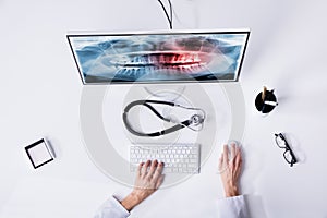 Dentist`s Hand Examining Teeth X-ray