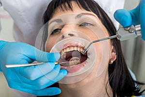 Dentist`s hands with mirror checking patient`s teeth