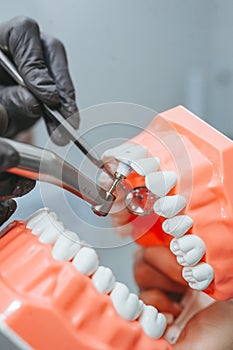 At the dentist`s office, close-up of the open model jaw. The doctor removing the tartar
